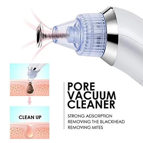 4-in-1 Vacuum Pore Cleaning Device