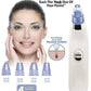 4-in-1 Vacuum Pore Cleaning Device