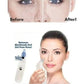 4-in-1 Vacuum Pore Cleaning Device