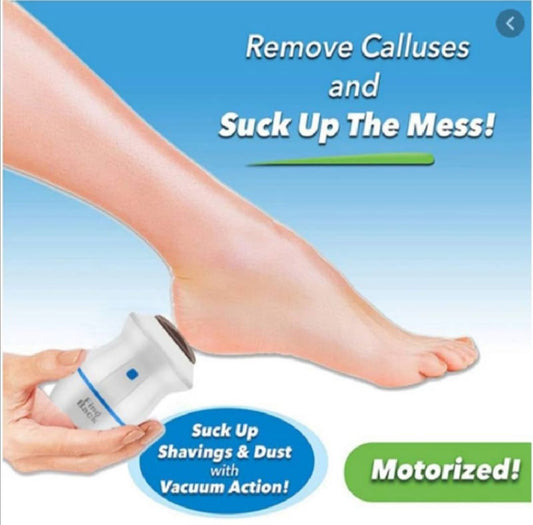 Portable Electric Foot Grinder